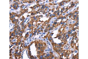 Immunohistochemistry (IHC) image for anti-Growth Regulation By Estrogen in Breast Cancer 1 (GREB1) antibody (ABIN2433111) (GREB1 anticorps)