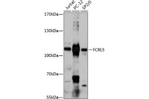 Western blot analysis of extracts of various cell lines, using FCRL5 antibody (ABIN6131547, ABIN6140565, ABIN6140566 and ABIN6217927) at 1:3000 dilution. (FCRL5 anticorps  (AA 16-190))