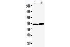Anti-PADI4/PAD4 antibody, Western blotting Lane 1: PANC Cell Lysate Lane 2: 293T Cell Lysate