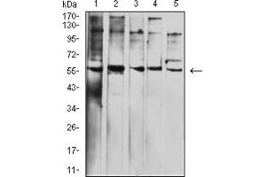 Western blot analysis using BTN1A1 mouse mAb against Hela (1), Jurkat (2), HepG2 (3), HT-29 (4), and MCF-7 (5) cell lysate.