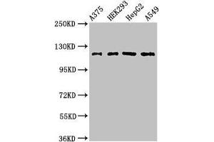 Western Blot Positive WB detected in: A375 whole cell lysate, HEK293 whole cell lysate, HepG2 whole cell lysate, A549 whole cell lysate All lanes: FARP1 antibody at 3 μg/mL Secondary Goat polyclonal to rabbit IgG at 1/50000 dilution Predicted band size: 119, 123, 15 kDa Observed band size: 119 kDa (FARP1 anticorps  (AA 1-300))