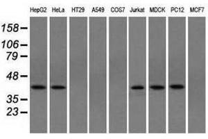 Image no. 4 for anti-Acetyl-CoA Acetyltransferase 2 (ACAT2) antibody (ABIN1496402) (ACAT2 anticorps)