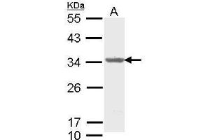 WB Image Sample (30 ug of whole cell lysate) A: Molt-4 , 12% SDS PAGE antibody diluted at 1:1000 (THO Complex 4 anticorps)