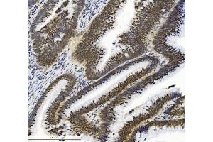 IHC analysis of SMAD2 using anti-SMAD2 antibody (ABIN7602542). (SMAD2 anticorps  (AA 83-264))