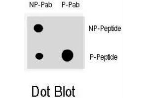Dot blot analysis of CDKN1A (phospho T145) polyclonal antibody  on nitrocellulose membrane. (p21 anticorps  (pThr145))