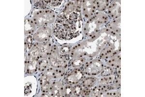Immunohistochemical staining (Formalin-fixed paraffin-embedded sections) of human kidney with KPNA6 polyclonal antibody  shows strong nuclear positivity in cells in tubules and cells in glomeruli. (KPNA6 anticorps)