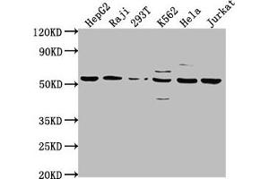 Western Blot Positive WB detected in: HepG2 whole cell lysate, Raji whole cell lysate, 293T whole cell lysate, K562 whole cell lysate, Hela whole cell lysate, Jurkat whole cell lysate All lanes: CAP1 antibody at 1:2000 Secondary Goat polyclonal to rabbit IgG at 1/50000 dilution Predicted band size: 52 kDa Observed band size: 52 kDa (CAP1 anticorps  (AA 22-157))