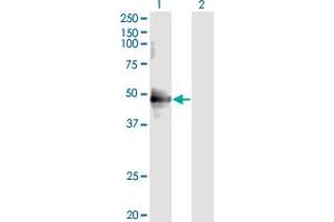 Western Blot analysis of CDC37 expression in transfected 293T cell line by CDC37 monoclonal antibody (M01), clone 3C7.