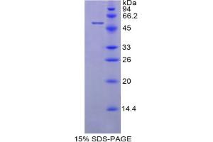 SDS-PAGE analysis of Cow LBP Protein. (LBP Protéine)