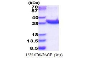 SDS-PAGE (SDS) image for Protein tyrosine Phosphatase, Receptor Type, C (PTPRC) (AA 1031-1251) protein (His tag) (ABIN6387391)