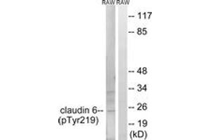 Western blot analysis of extracts from RAW264. (Claudin 6 anticorps  (pTyr219))
