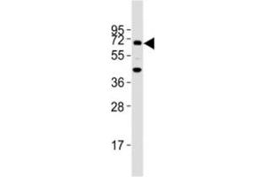 Western blot testing of TGFBR2 antibody at 1:2000 dilution + mouse lung lysate; Predicted molecular weight ~ 65 kDa. (TGFBR2 anticorps  (AA 13-40))