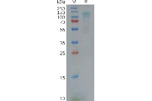 Human AD Protein, His Tag on SDS-PAGE under reducing condition.