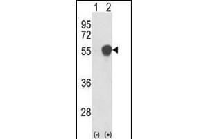 Western blot analysis of PHGDH (arrow) using rabbit polyclonal PHGDH Antibody (N-term) (ABIN389483 and ABIN2839543). (PHGDH anticorps  (N-Term))