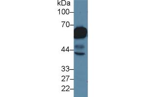 Detection of CK5 in Rat Tongue lysate using Polyclonal Antibody to Cytokeratin 5 (CK5) (Cytokeratin 5 anticorps  (AA 163-471))