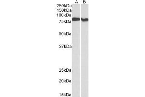 ABIN1590084 (0. (PKC beta anticorps  (Internal Region))