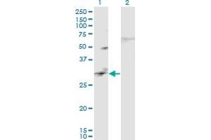 Western Blot analysis of CAPS2 expression in transfected 293T cell line by CAPS2 monoclonal antibody (M02), clone 3C6. (Calcyphosine 2 anticorps  (AA 285-382))