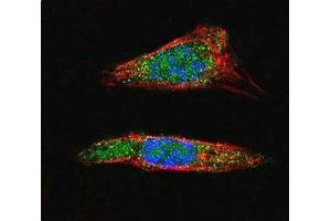 Confocal immunofluorescent analysis of SUMO1 antibody with A375 cells followed by Alexa Fluor 488-conjugated goat anti-rabbit lgG (green).