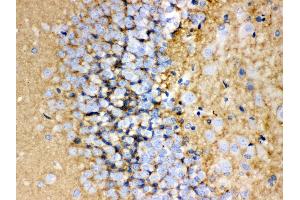 Anti-GAP43 antibody, IHC(P) IHC(P): Rat Brain Tissue (GAP43 anticorps  (C-Term))