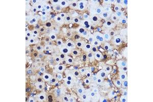 Immunohistochemistry of paraffin-embedded Human liver using PP1 beta Rabbit pAb (ABIN3021408, ABIN3021409, ABIN3021410 and ABIN6215019) at dilution of 1:100 (40x lens).