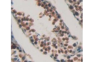 Figure. (CHEK1 anticorps  (AA 194-446))