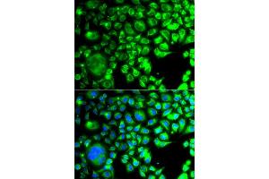 Immunofluorescence analysis of A549 cell using TBPL1 antibody. (TBPL1 anticorps)