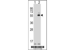 Western blot analysis of Camk2d using rabbit polyclonal Mouse Camk2d Antibody using 293 cell lysates (2 ug/lane) either nontransfected (Lane 1) or transiently transfected (Lane 2) with the Camk2d gene. (CAMK2D anticorps  (AA 221-250))