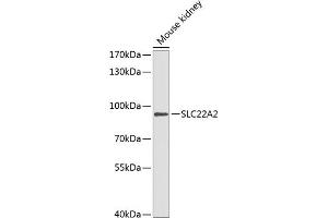 Western blot analysis of extracts of mouse kidney, using SLC22 antibody (ABIN6129479, ABIN6147886, ABIN6147888 and ABIN6218288) at 1:1000 dilution. (SLC22A2 anticorps  (AA 44-140))