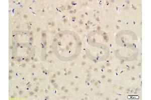 Formalin-fixed and paraffin embedded rat brain tissue labeled with Anti-PITX3 Polyclonal Antibody (ABIN679988) , Unconjugated at 1:200 followed by conjugation to the secondary antibody (PITX3 anticorps  (AA 231-302))