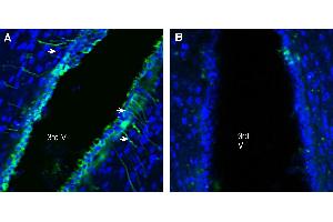 Expression of GABA(A) Receptor Beta 2 in rat hypothalamus.