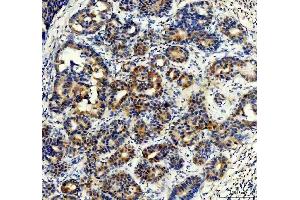 IHC analysis of Synip/STXBP4 using anti-Synip/STXBP4 antibody (ABIN7602066).