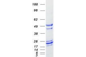 Validation with Western Blot
