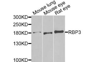 Western blot analysis of extracts of various cells, using RBP3 antibody. (RBP3 anticorps)