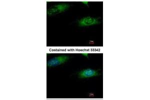 ICC/IF Image Immunofluorescence analysis of methanol-fixed HeLa, using Ribophorin I, antibody at 1:500 dilution.