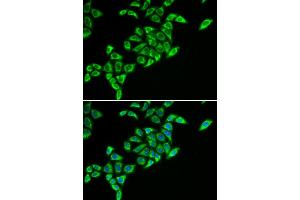 Immunofluorescence (IF) image for anti-Dihydrolipoyl Transacetylase (DLAT) antibody (ABIN1980304)