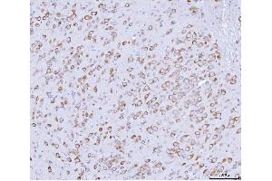 IHC analysis of PRKRA using anti-PRKRA antibody (ABIN7600141).