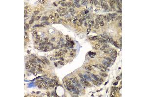 Immunohistochemistry of paraffin-embedded human colon using UFD1L antibody at dilution of 1:100 (x40 lens). (UFD1L anticorps)