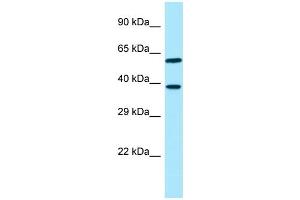 WB Suggested Anti-EIF3I Antibody Titration: 1. (EIF3I anticorps  (Middle Region))