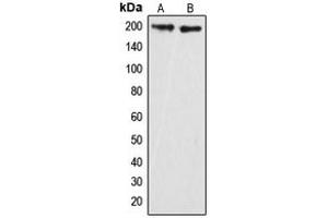 Western blot analysis of GRLF1 (pY1087) expression in HeLa (A), mouse brain (B) whole cell lysates. (GRLF1 anticorps  (pTyr1087))