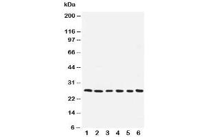 Western blot testing of ARC antibody and human samples 1:  SMMC-7721 (NOL3 anticorps  (AA 91-106))