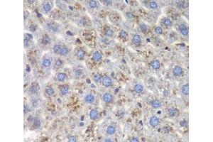 Immunohistochemistry of paraffin-embedded Mouse liver using SND1 Polyclonal Antibody at dilution of 1:100 (40x lens).