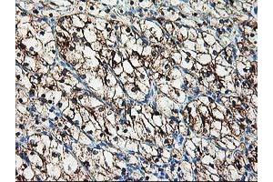 Image no. 1 for anti-Adenylate Kinase 4 (AK4) antibody (ABIN1496527) (AK4 anticorps)