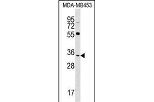 FKBP6 Antibody (C-term) (ABIN1536953 and ABIN2848611) western blot analysis in MDA-M cell line lysates (35 μg/lane). (FKBP6 anticorps  (C-Term))