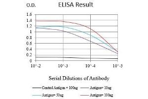Black line: Control Antigen (100 ng),Purple line: Antigen (10 ng), Blue line: Antigen (50 ng), Red line:Antigen (100 ng)