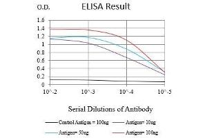 Black line: Control Antigen (100 ng),Purple line: Antigen (10 ng), Blue line: Antigen (50 ng), Red line:Antigen (100 ng) (Ki-67 anticorps  (AA 1160-1493))