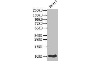 Western Blot Positive WB detected in: Mouse heart tissue All lanes: IAPP antibody at 1 μg/mL Secondary Goat polyclonal to rabbit IgG at 1/50000 dilution Predicted band size: 10 kDa Observed band size: 10 kDa