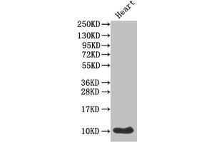 Western Blot Positive WB detected in: Mouse heart tissue All lanes: IAPP antibody at 1 μg/mL Secondary Goat polyclonal to rabbit IgG at 1/50000 dilution Predicted band size: 10 kDa Observed band size: 10 kDa (Amylin/DAP anticorps  (AA 34-70))