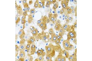 Immunohistochemistry of paraffin-embedded human liver using GABARAP antibody.