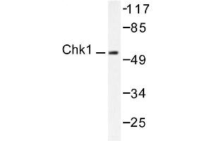 Image no. 1 for anti-Checkpoint Kinase 1 (CHEK1) antibody (ABIN265347) (CHEK1 anticorps)