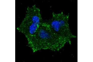 Fluorescent confocal image of MCF7 cells stained with phospho-ERBB2- antibody.
